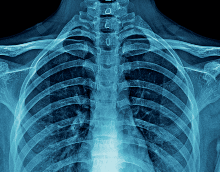 xrai technology chest x-ray