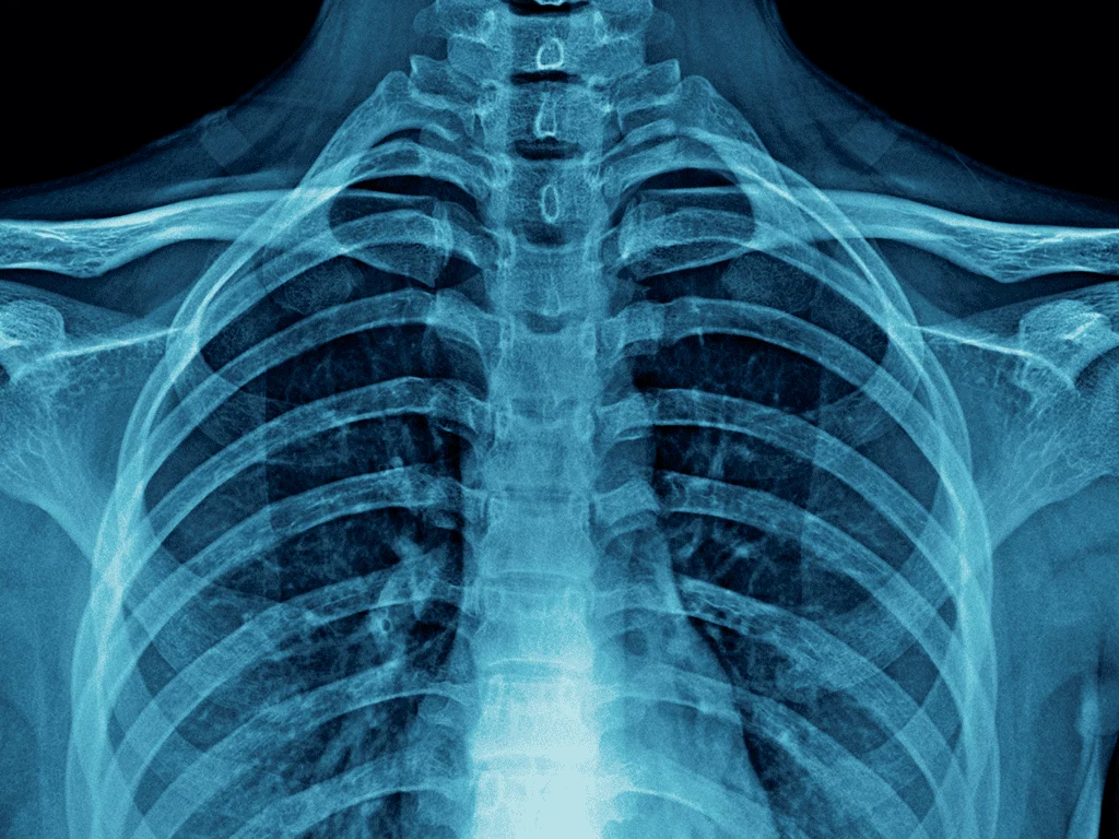 xrai technology chest x-ray