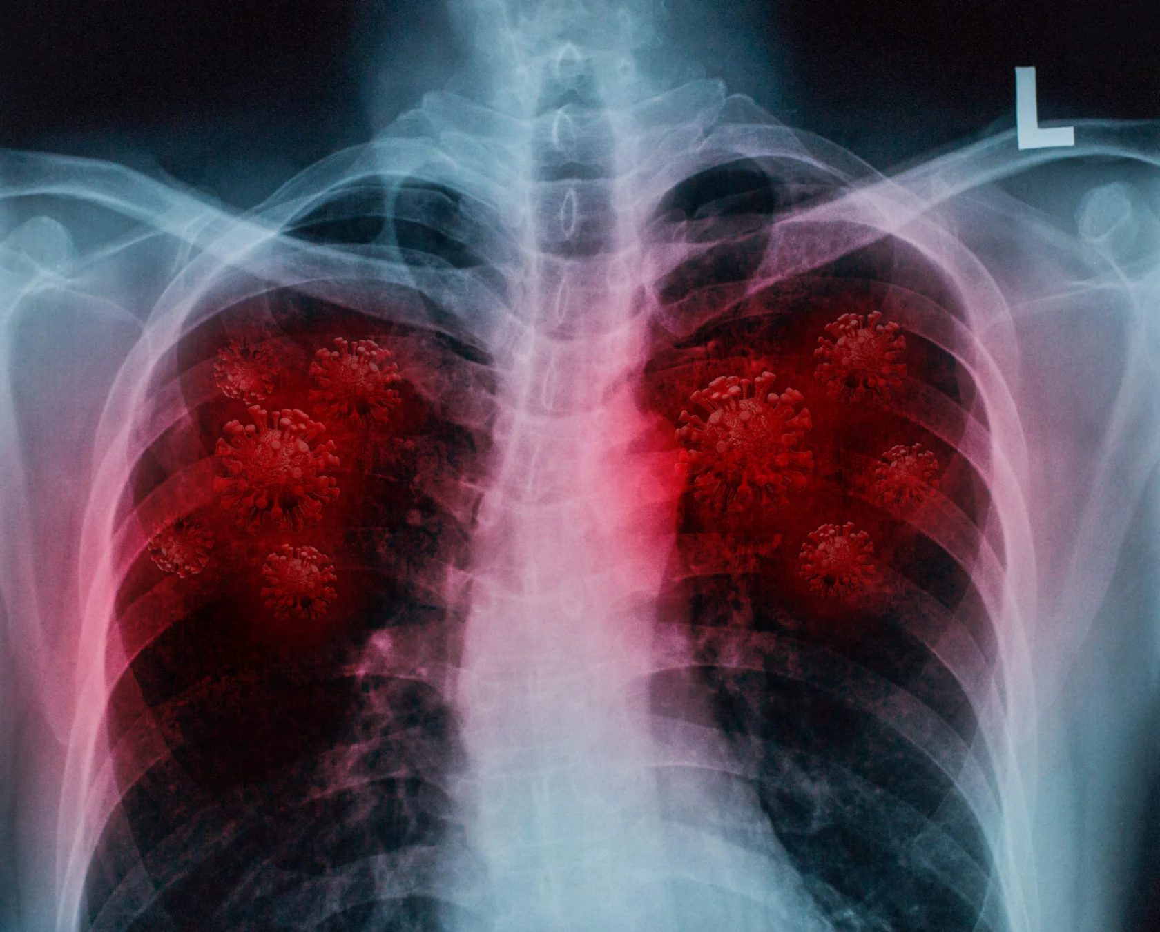 Leveraging AI to Enhance Treatment for Severe COVID Patients e1633572397701